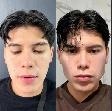 Masculinización